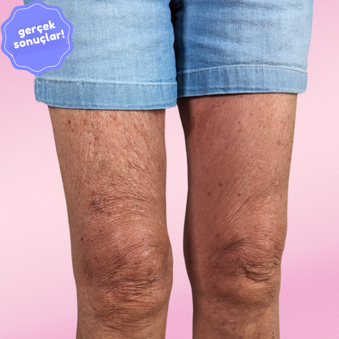 the instalift - leg lifter