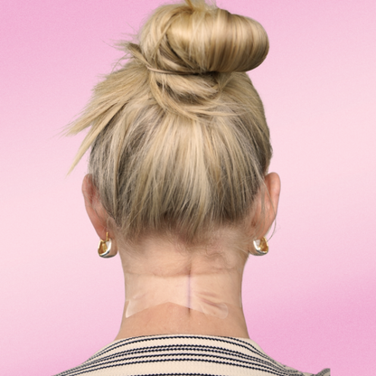 the instalift - neck lifter