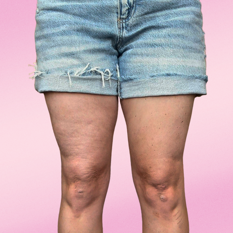 the instalift - leg lifter